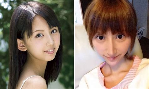 nanatsuki rina|Japanese Idol Rina Nanase's Extreme Plastic Surgery .